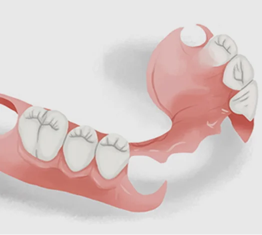 Dentures & Partial Dentures